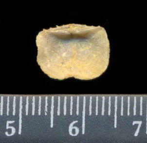 Lissochonetes geinitzianus (Waagen, 1884)